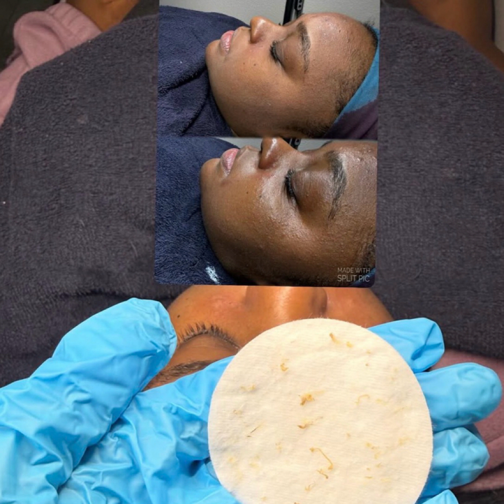 Deep Pore Facial at Radiance Skin in Pensacola, FL