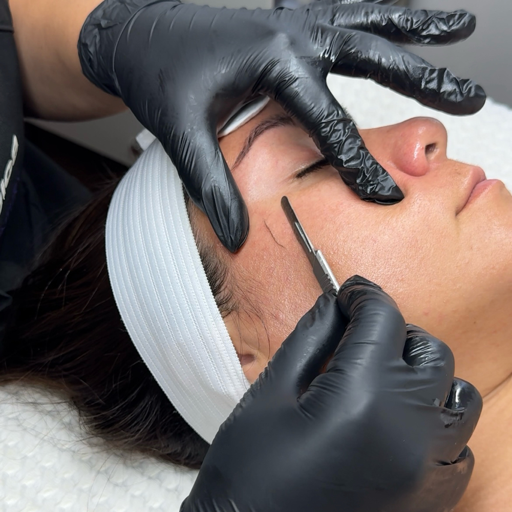 Dermaplane Facial at Everglow Esthetics in Downey, CA