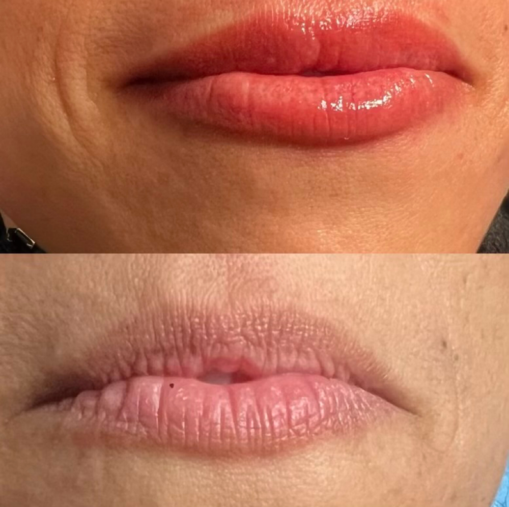 Dark Lips Neutralizer at Nina Beauty&Brows Studio in North Hollywood, CA