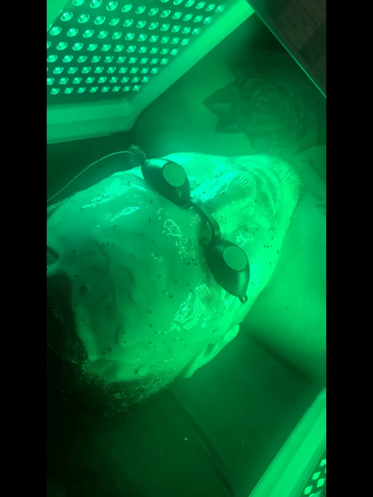 Add On: Led Photo Light Therapy