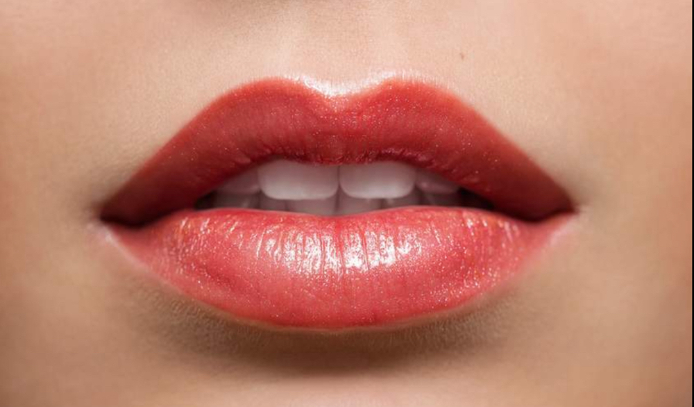 Lip filler