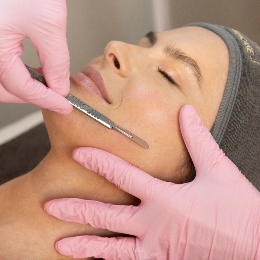 Dermaplane Add On at Willow Wellness Spa in Indianapolis, IN