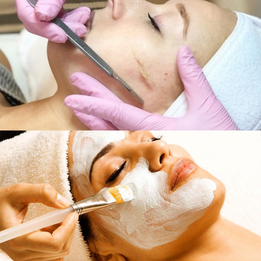 Dermaplane Facial