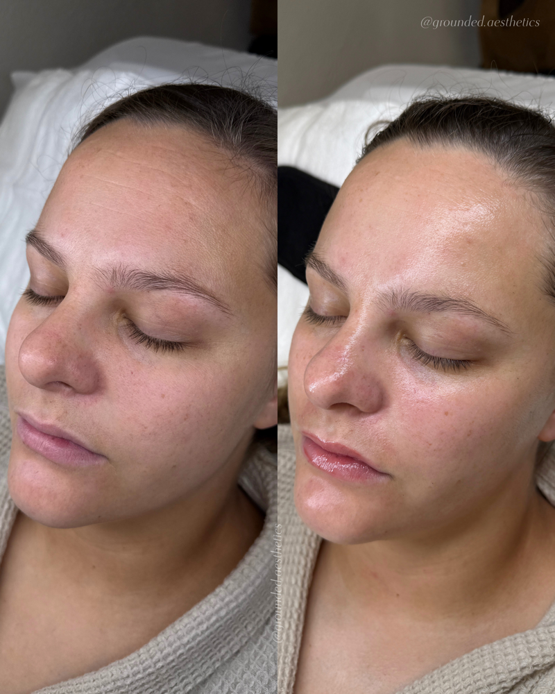glass skin facial at grounded wellness in San Antonio, TX