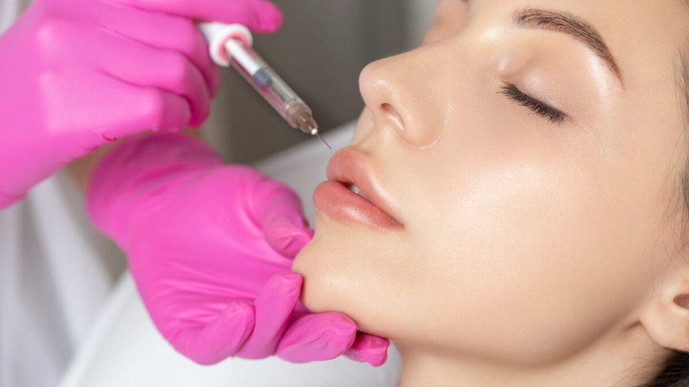 Lip Flip With Botox