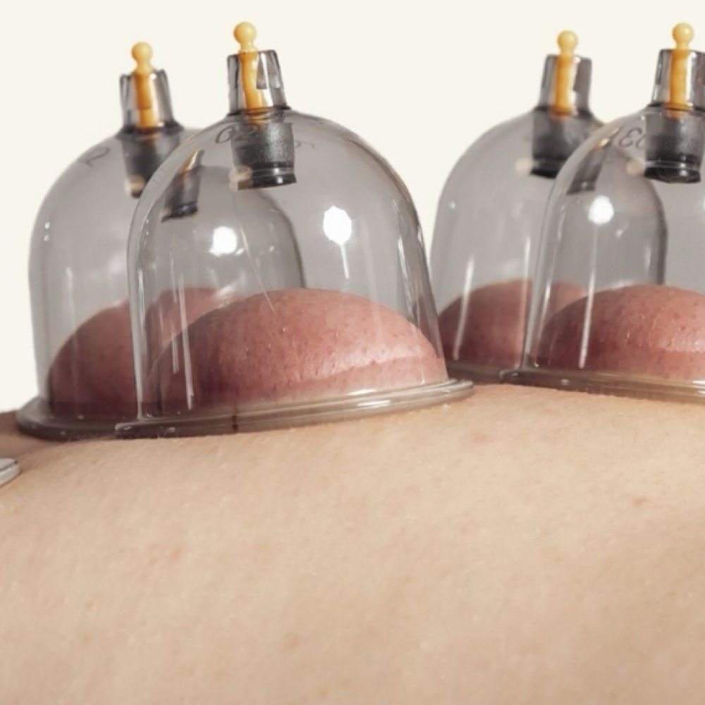 The Unstick (90min) — Cupping + my at Relax Naturally in Des Moines, IA