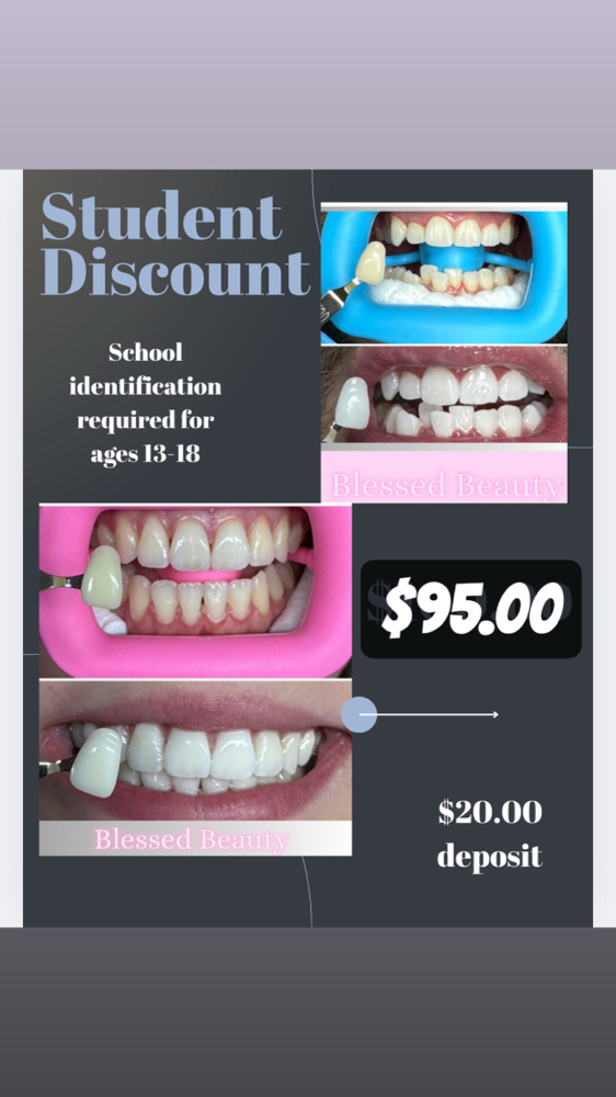 Teeth Whitening/ Student Discount at Blessed Beauty in El Paso, TX