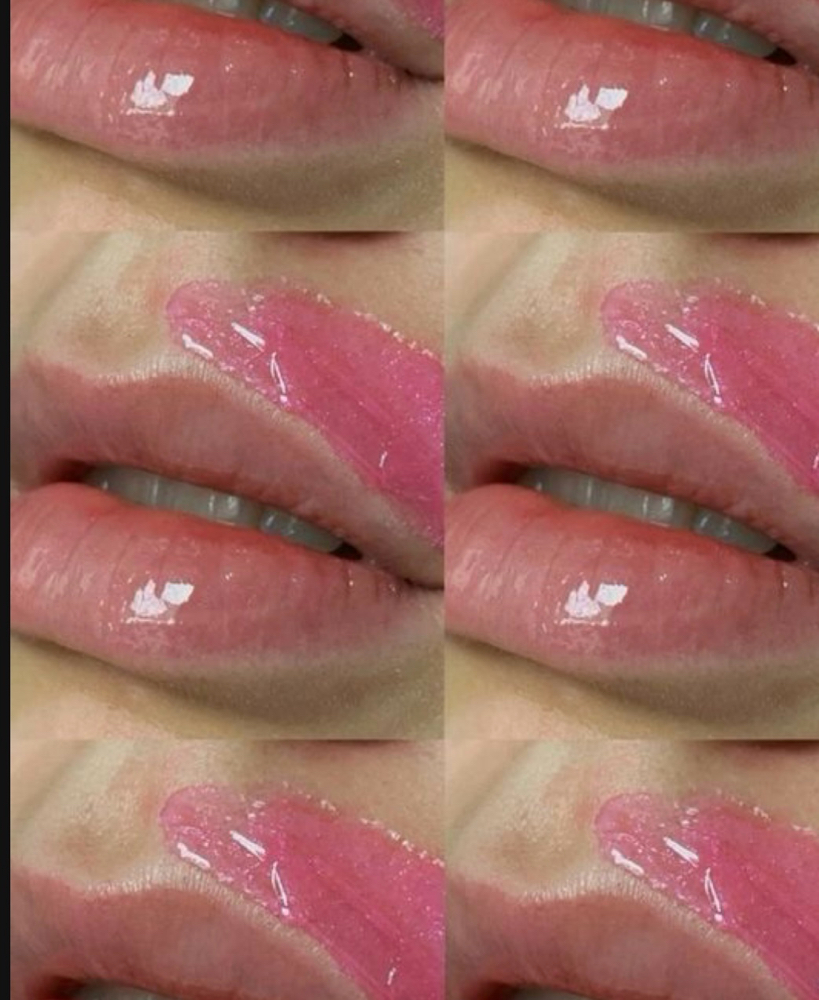 Face (Lip, Chin, Cheeks, Forehead)