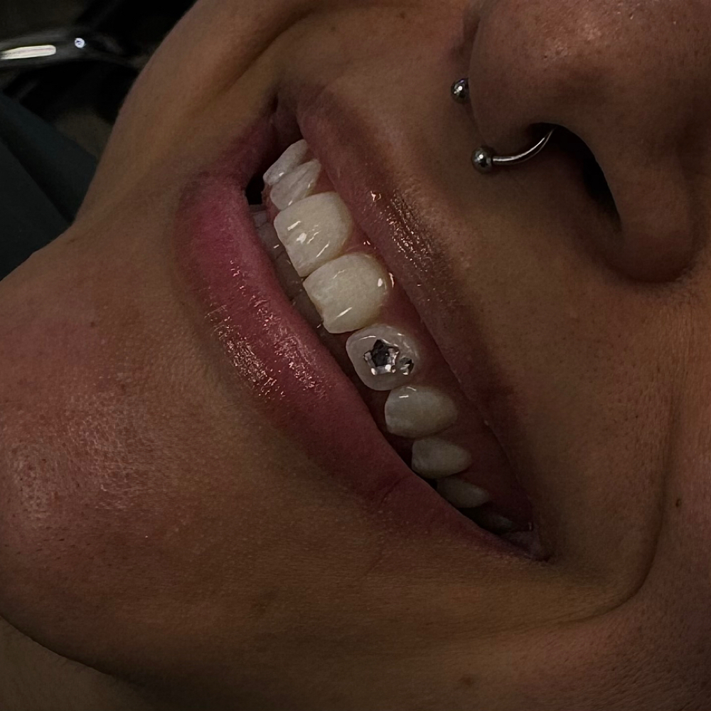 Tooth Gem Consultation at PiercingSiren in Waukegan, IL