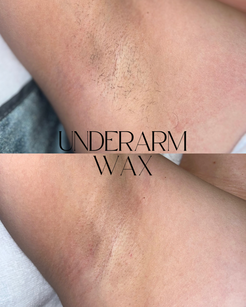 Underarms