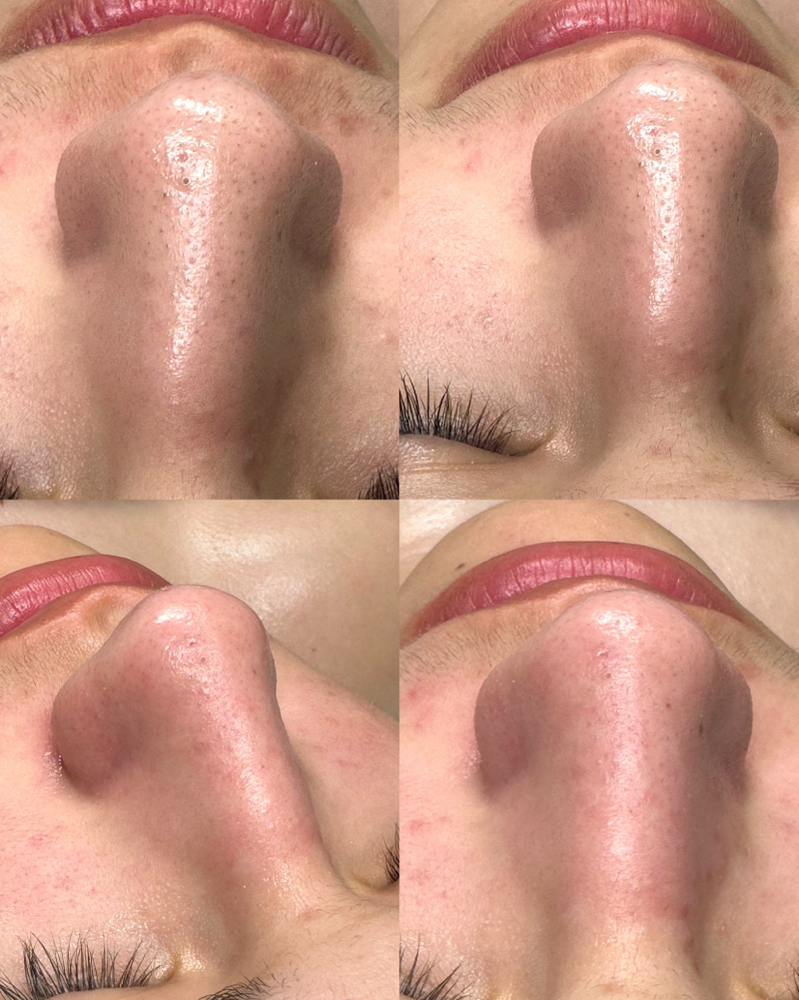 Deep Cleansing Facial