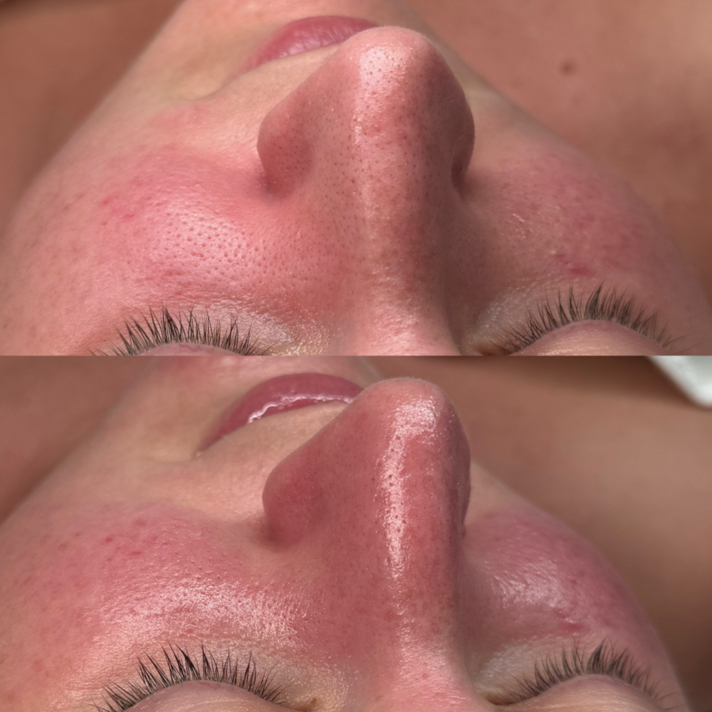Skin Detox Facial at BROWHAUS INK & BEAUTY in Tampa, FL