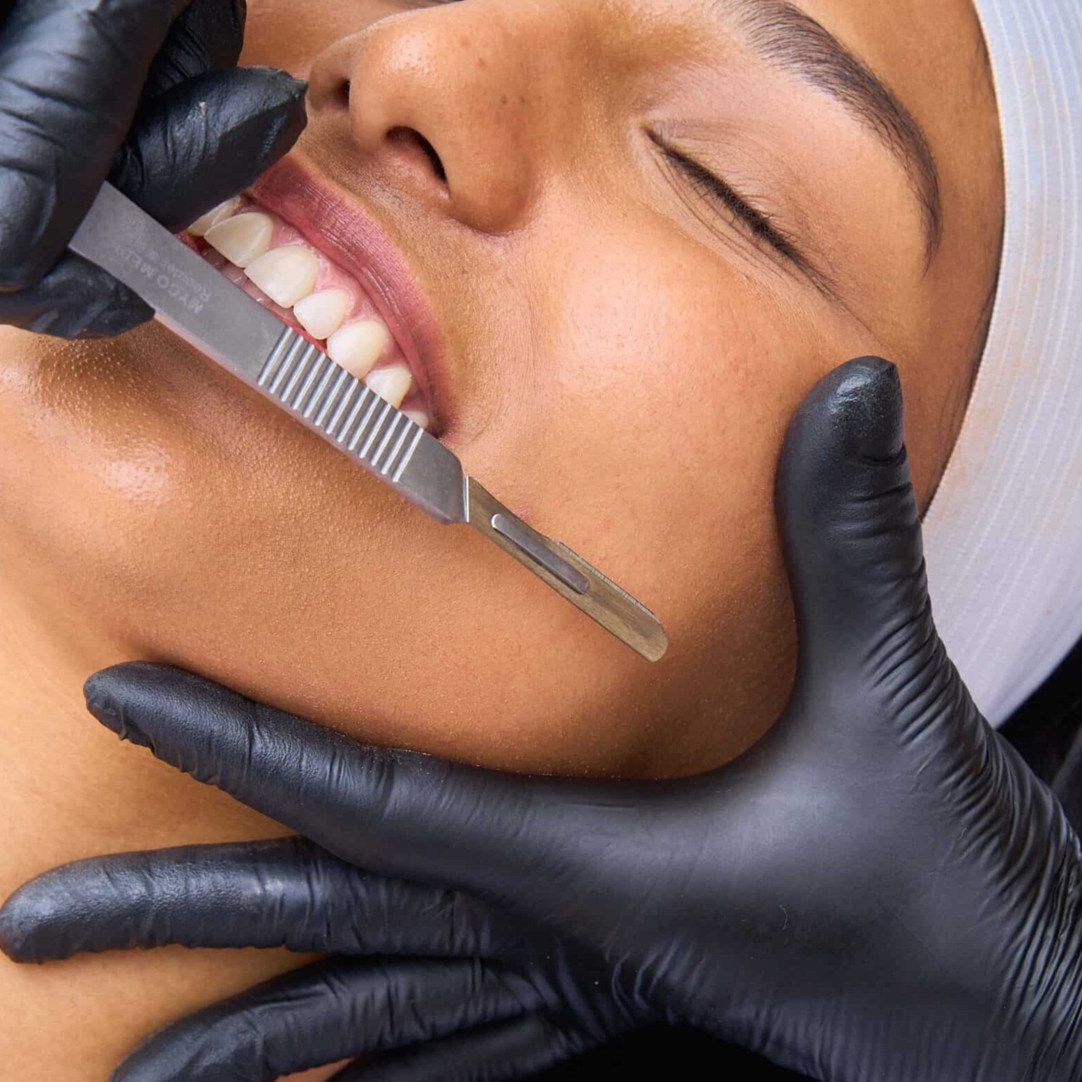 Custom Facial + Dermaplane at SKIN + BODY Aesthetics in Troy, MI