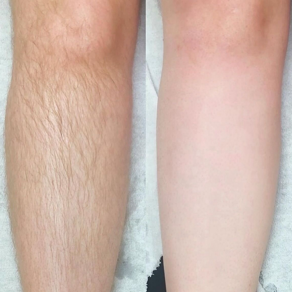 Leg Wax at Glow Beauty Lounge in New Concord, OH