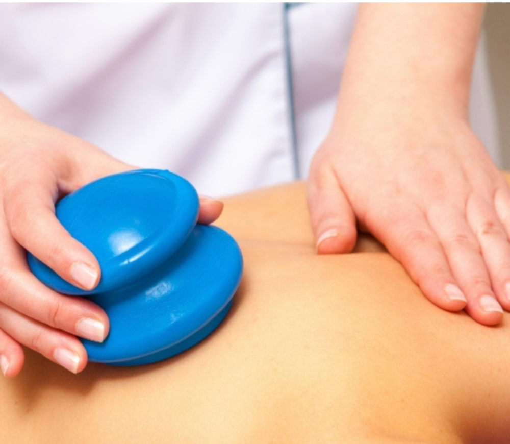 Cupping Massage