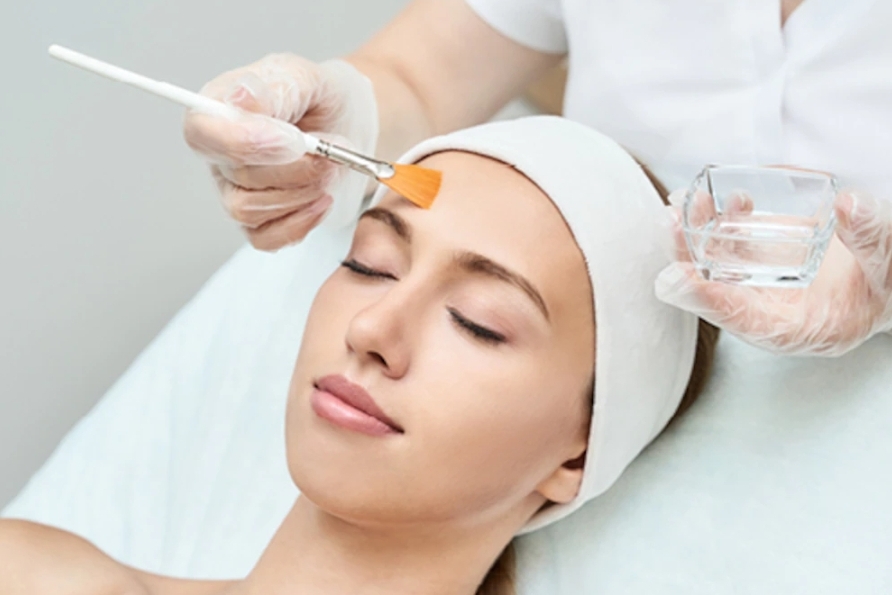 Chemical Peel