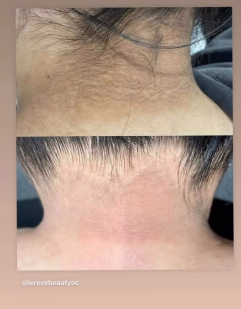 Skin Lightening & Brightening