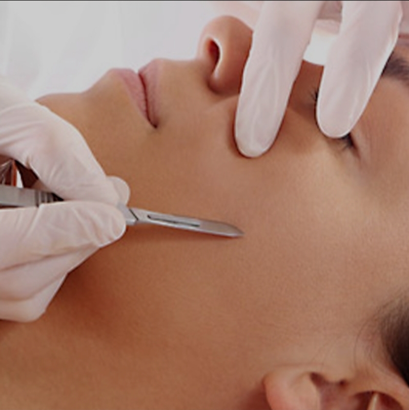 Dermaplaning Facial