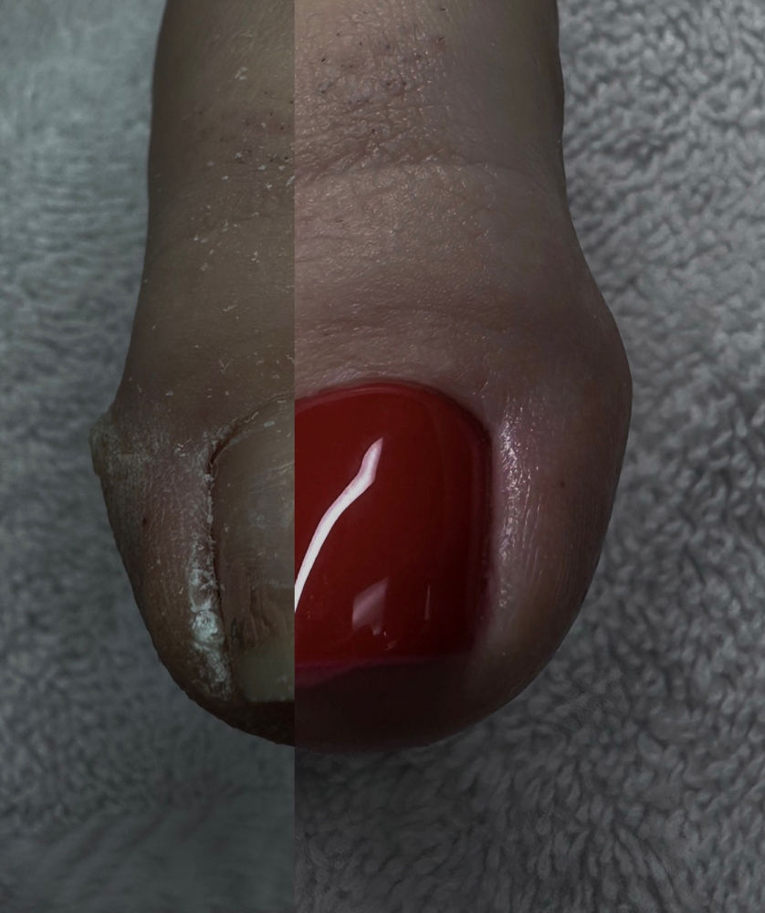 Smart Gel Pedicure (waterless)