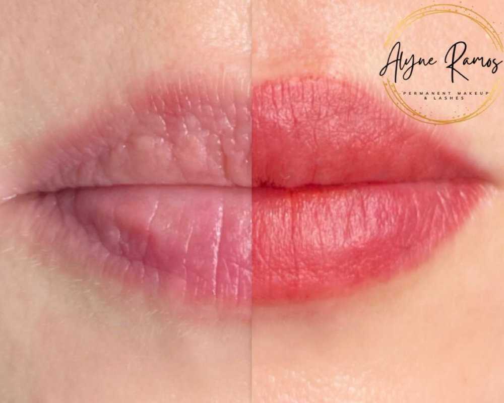 Lip Micropigmentation