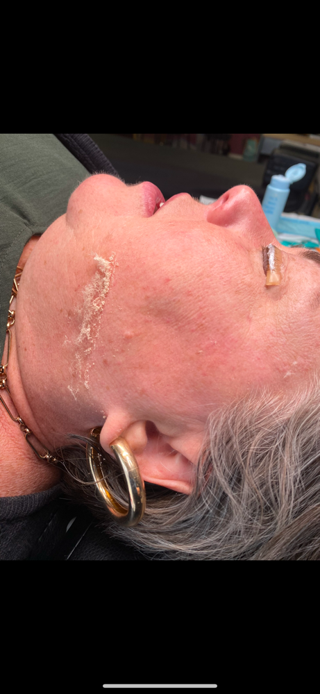 Dermaplaning Facial