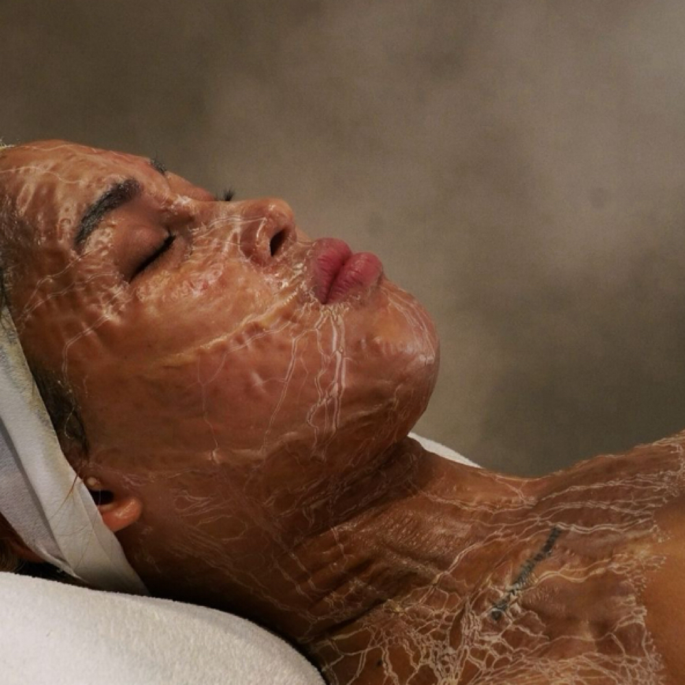 Korean Aging VTox Treatment at BSkinAesthetics in McKinney, TX