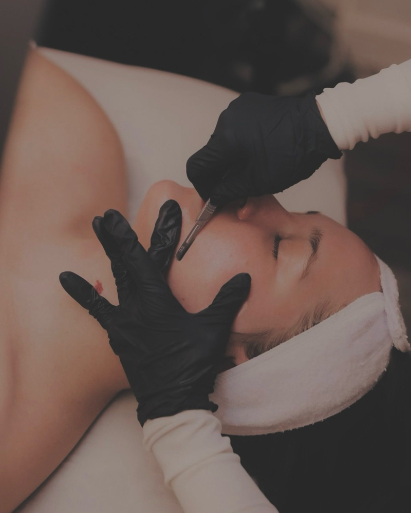 Dermaplane Facial