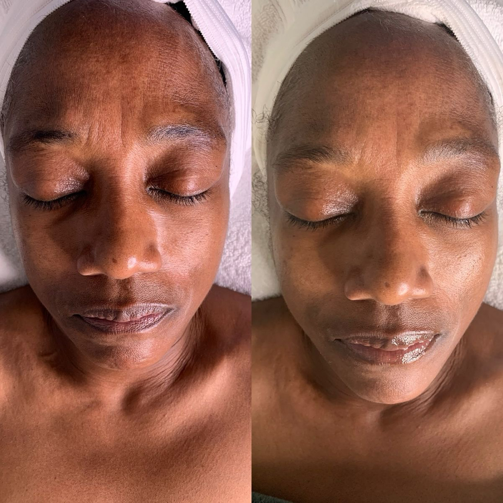 Aging Backwards Facial