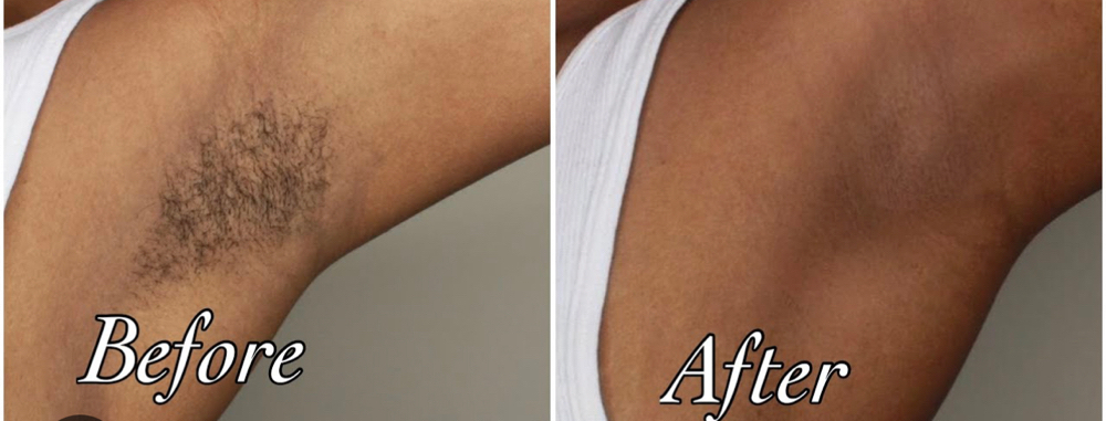 Under Arm Waxing