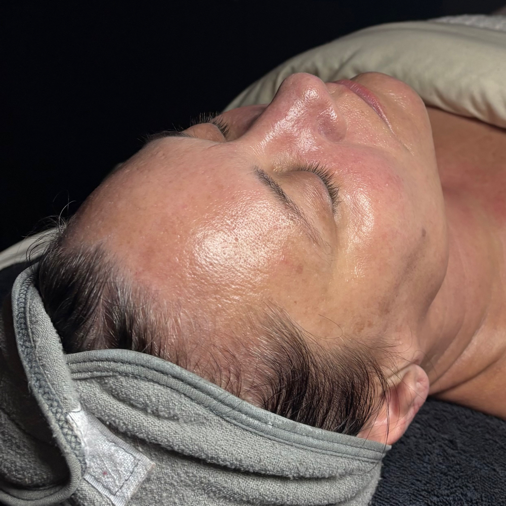 Dermaplane & Go