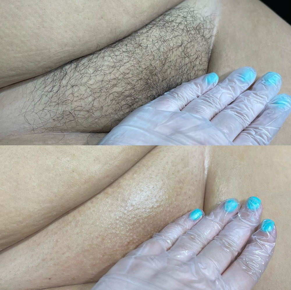 NEW CLIENT Women's Bikini Full Wax