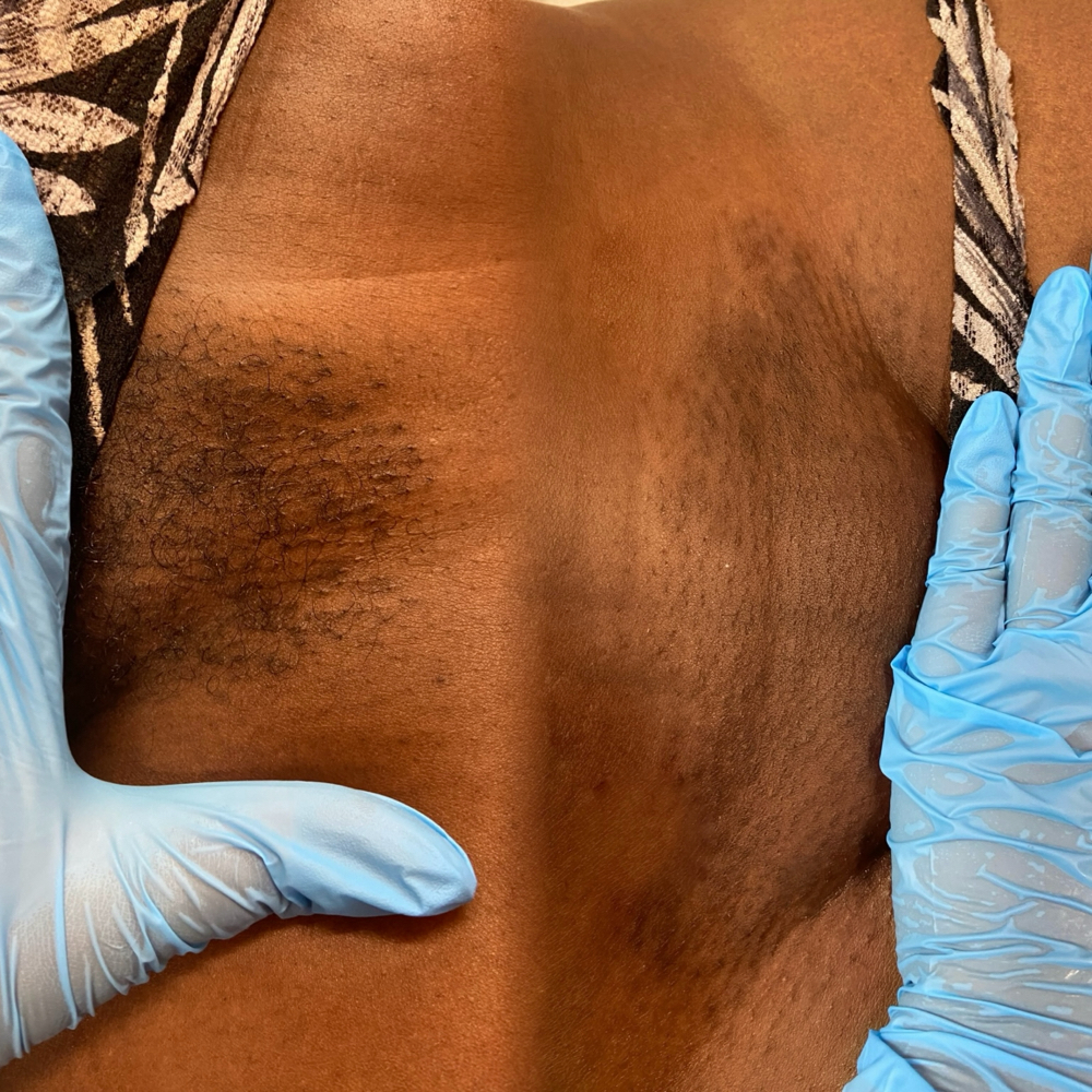 Brazilian Wax