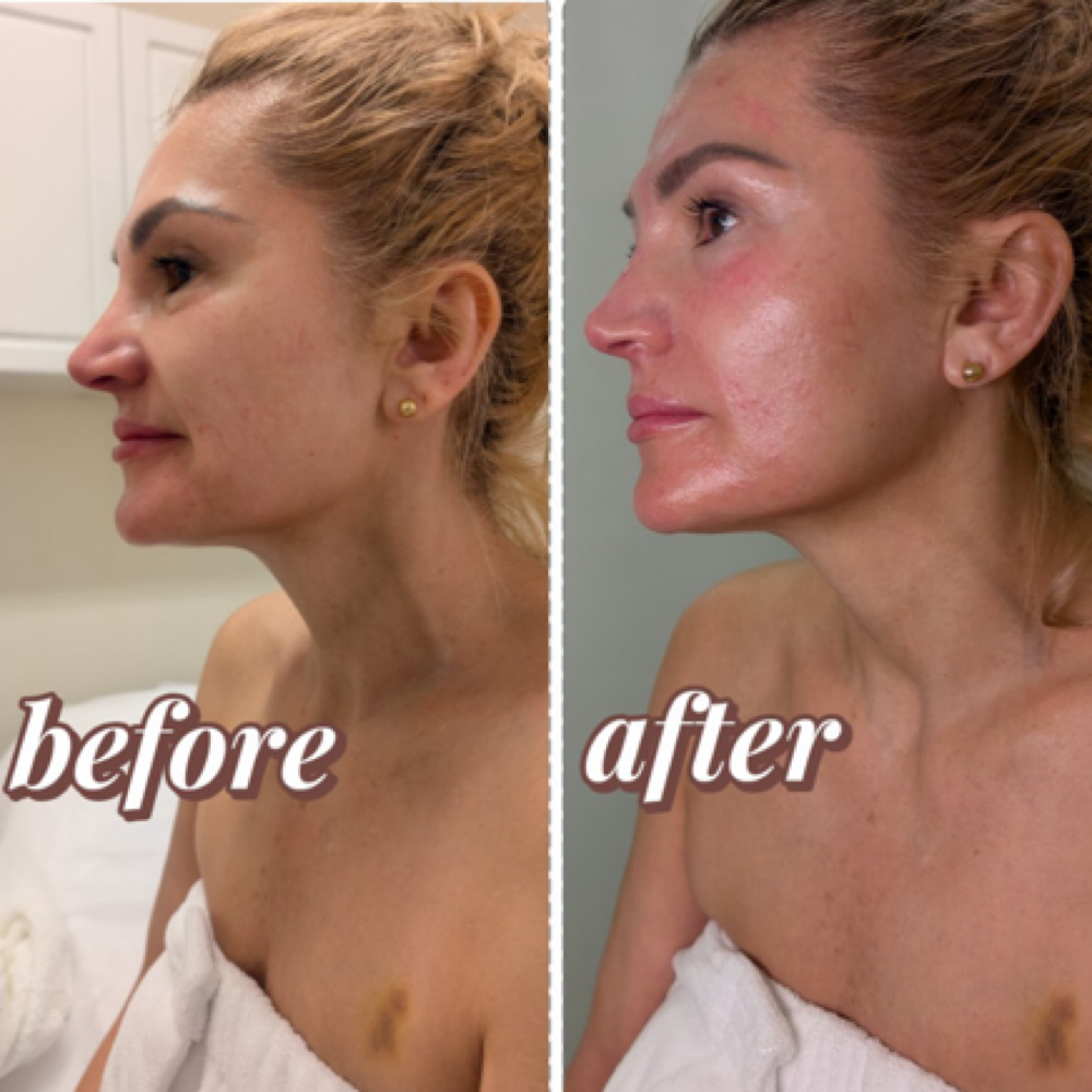 Anti-aging Facial at Nenusk Aesthetics in Long Island City, NY