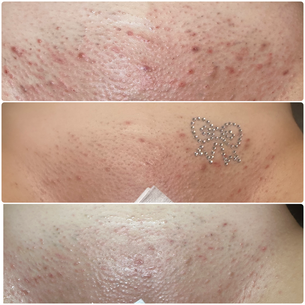 The Smooth Operator at Kalesthetics in Jacksonville, FL