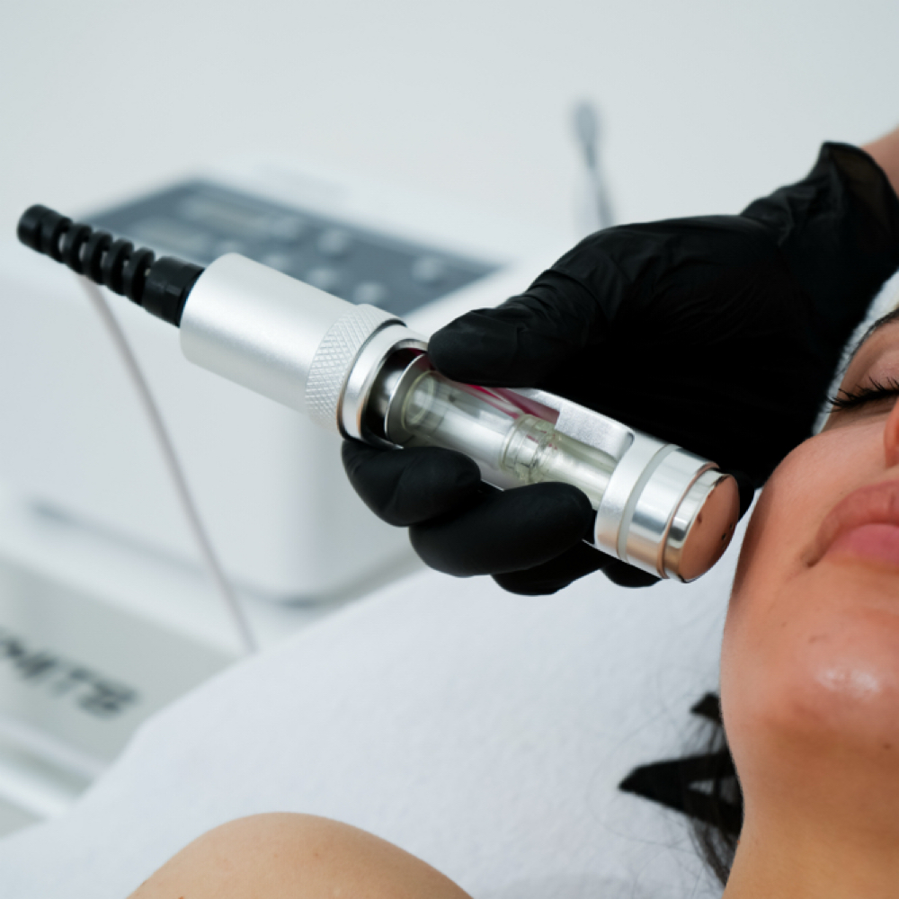 Dream Skin -  Electroporation at Atmosphere Skin Sanctuary Skin Wellness Center Fanwood in Fanwood, NJ