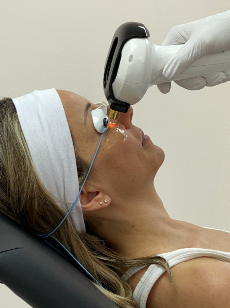 IPL Dry Eye Therapy