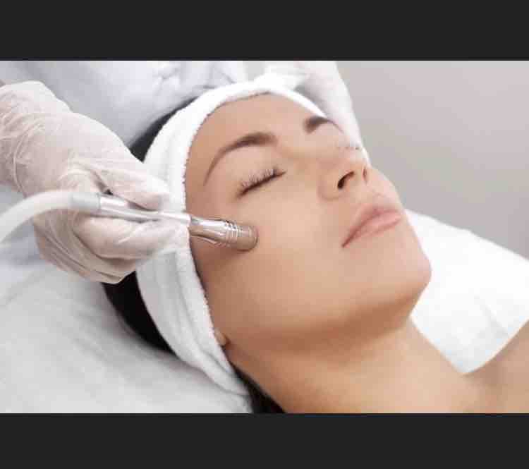 Microdermabrsion Facial