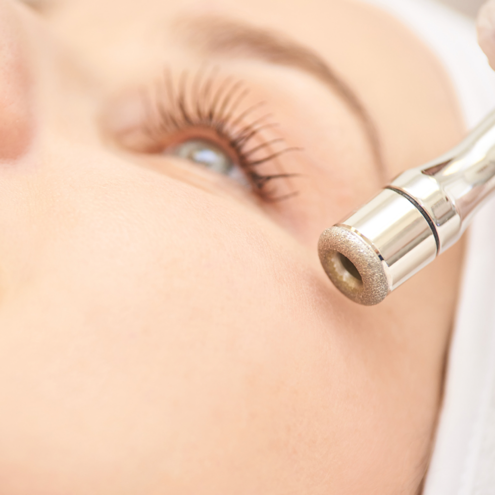 Microderm Facial