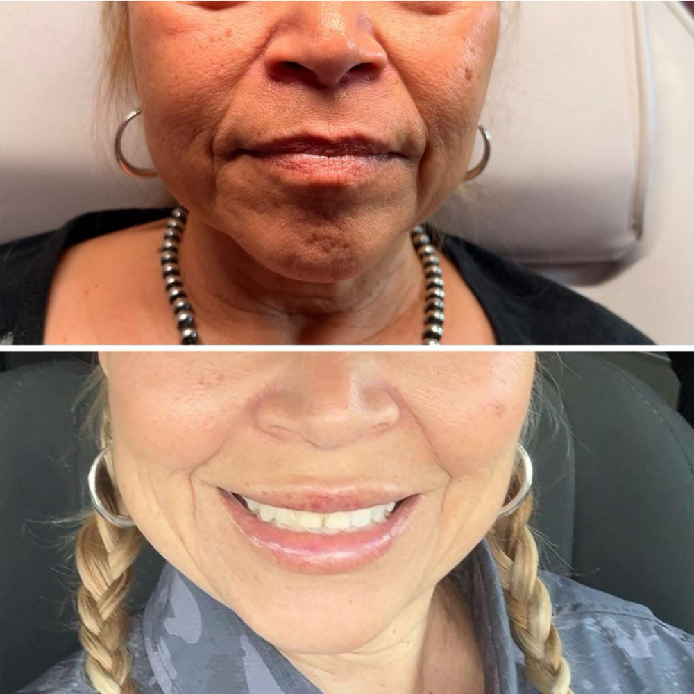 Facial Balancing at The Sculpting Spa in Alice, TX