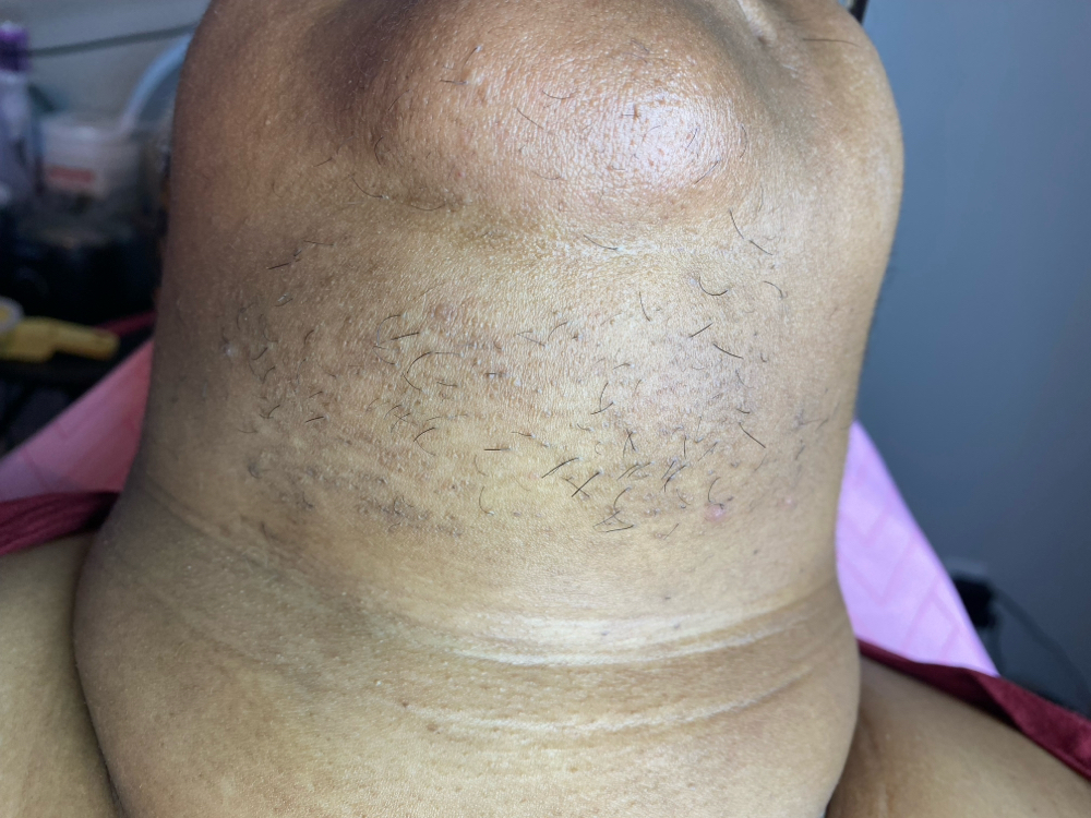 Pcos Full Face Wax at Eximius Bella in Garner, NC