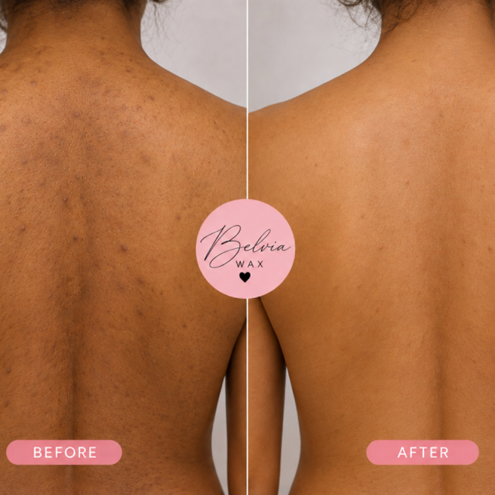Back Facial at Belvia Wax Co. Studio in Tempe, AZ