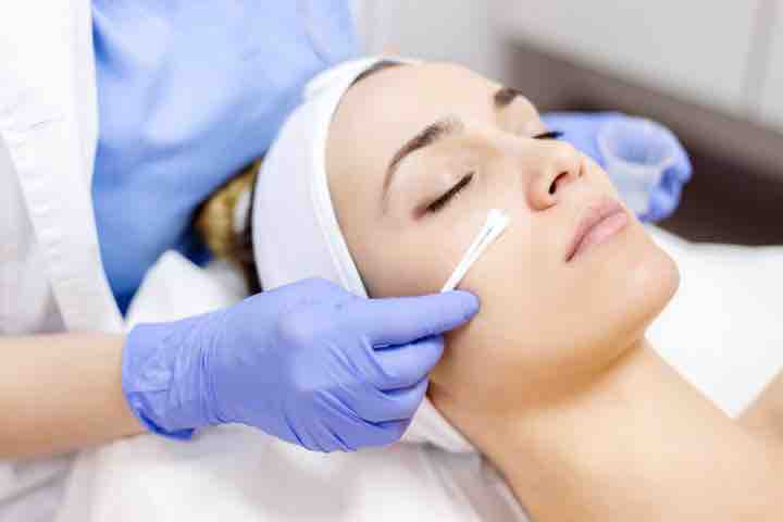 Add-on Chemical Peel