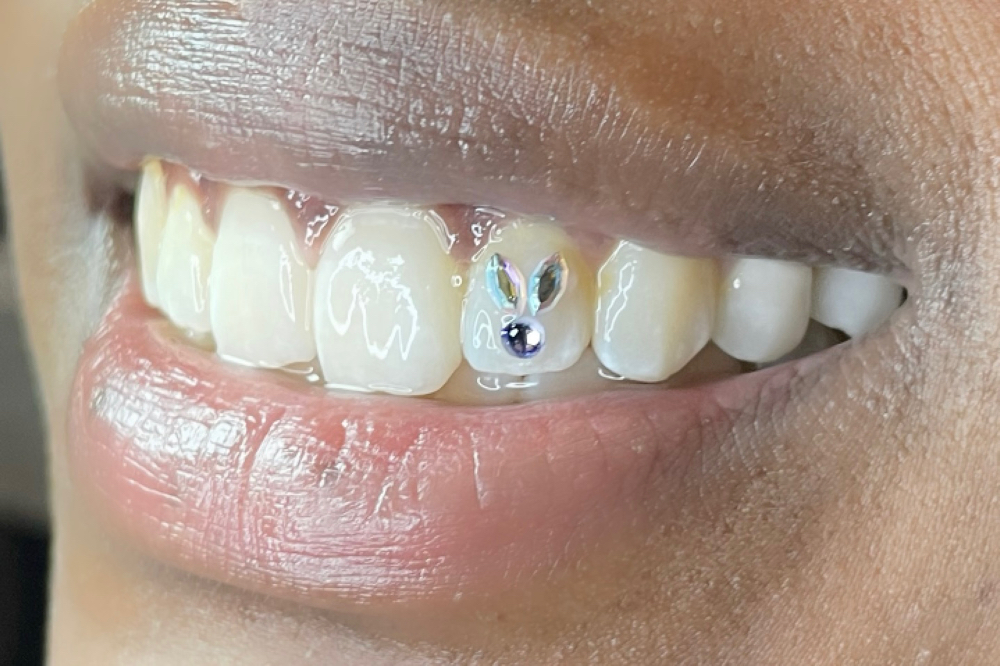 Bunny Tooth Crystals