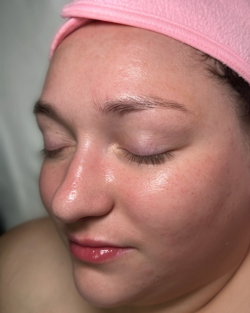 Self-Love facial