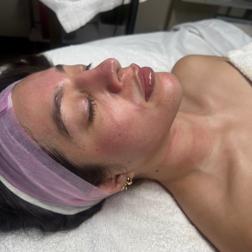 New Client Facial Special at Celestial Aesthetics in College Station, TX