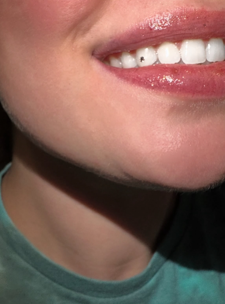 1x Swarvoski Crystal at Nabi Aesthetics in Nashville, TN