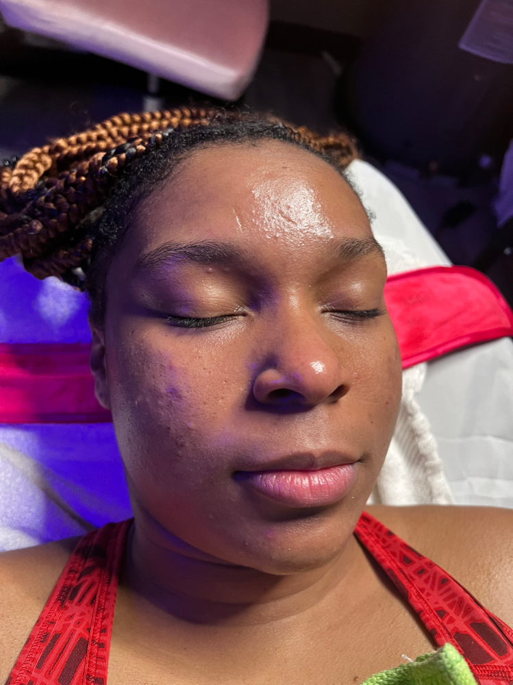Pre-Teen/Teenage Customized Facial