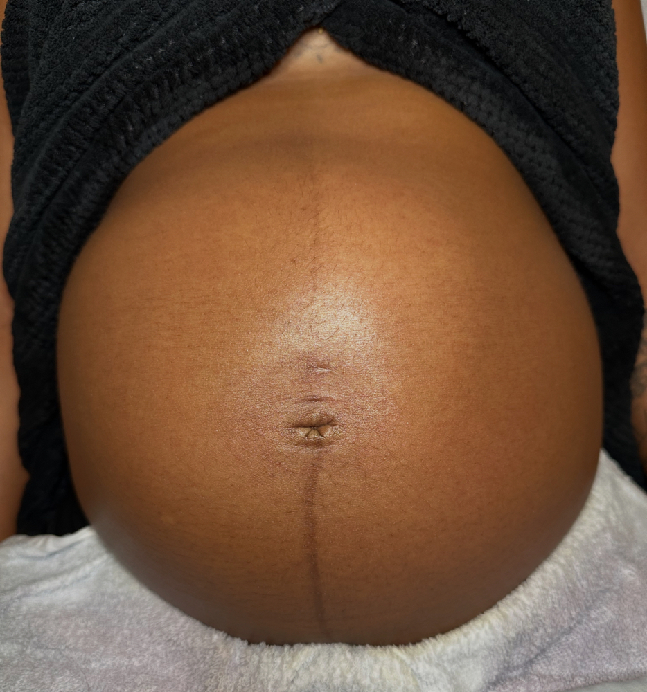 Belly Facial