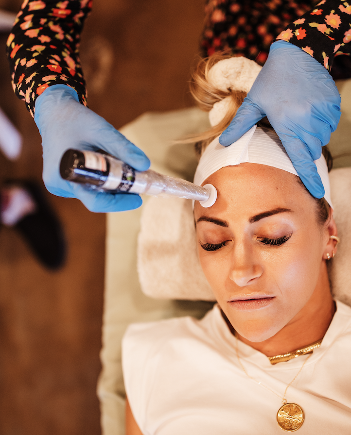 Procell Microchanneling Treatment