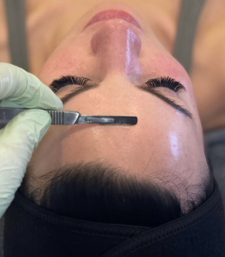 Dermaplaning Facial